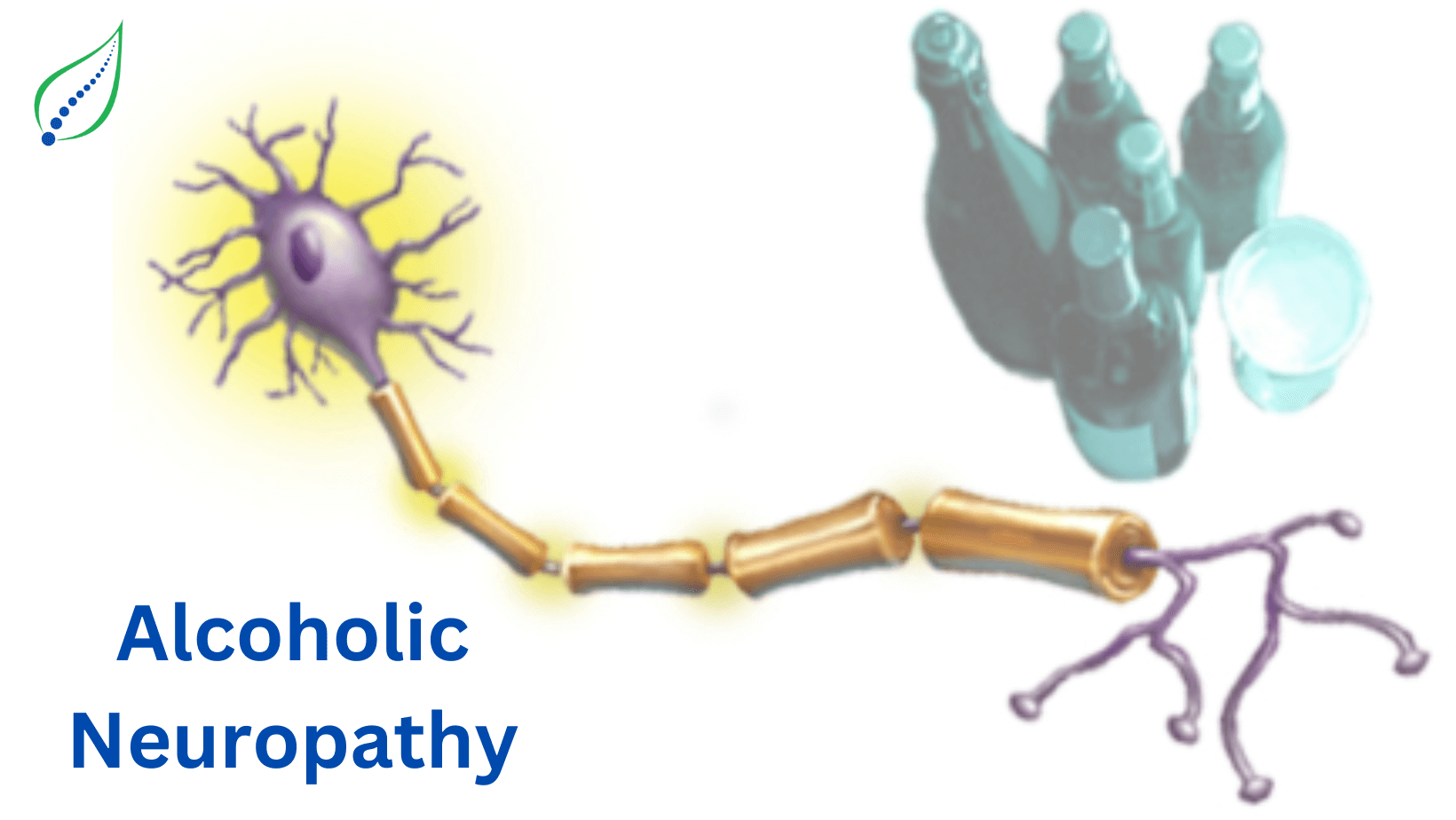 alcoholic-neuropathy