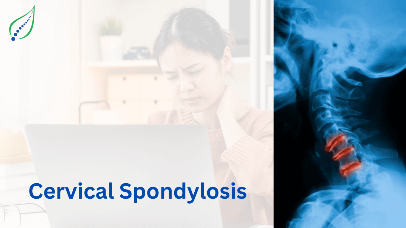 cervical-spondylosis