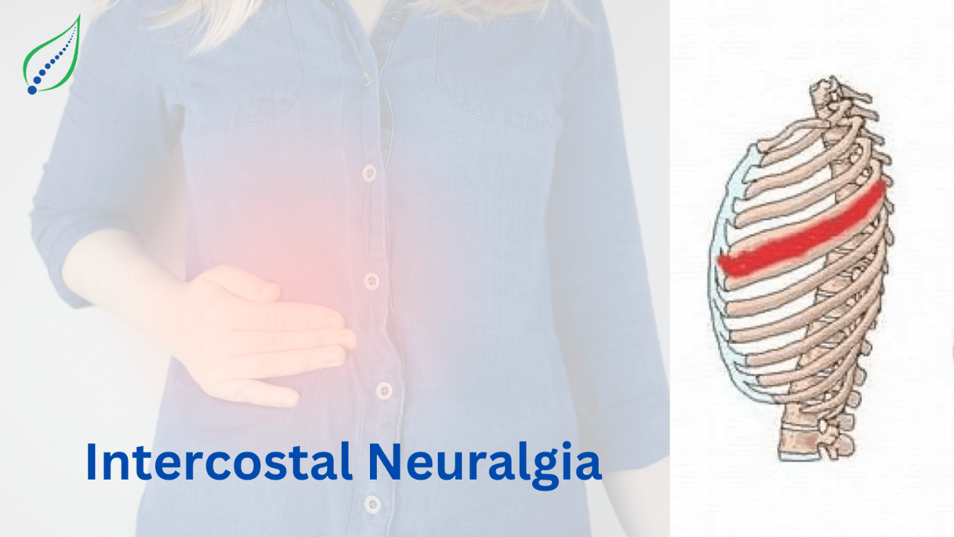 intercostal-neuralgia