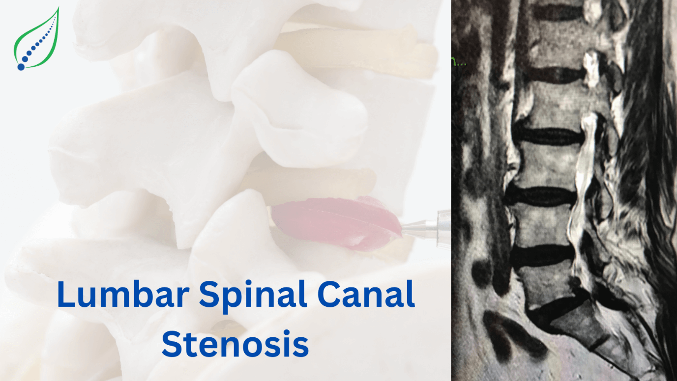 Lumbar Spinal Canal stenosis