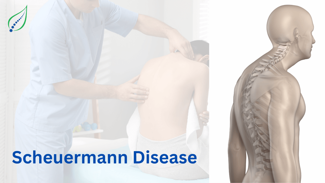 scheuermann-disease