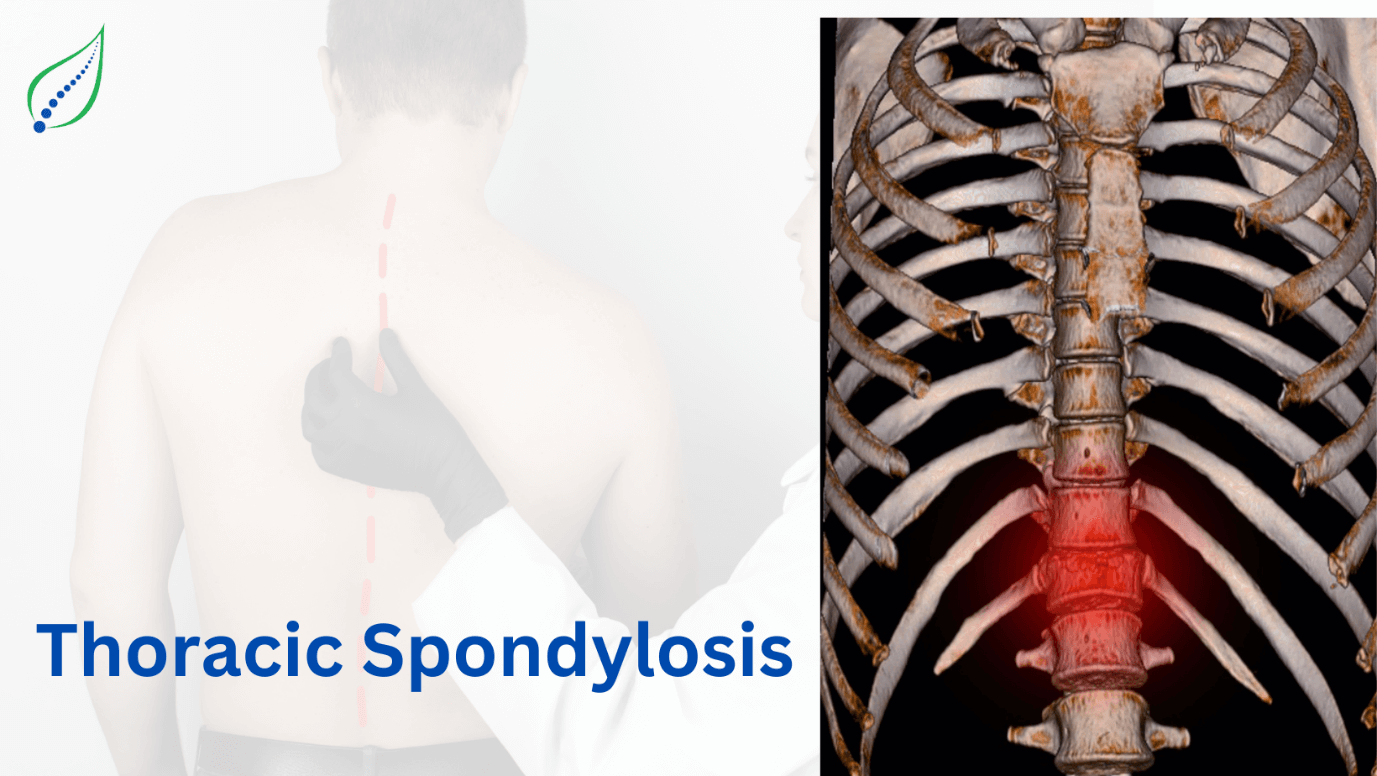thoracic-spondylosis