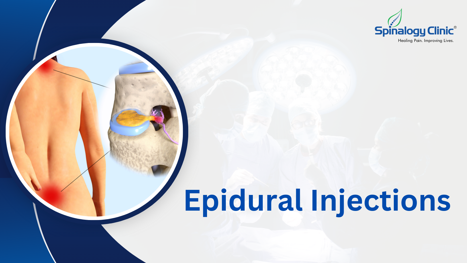 Epidural Injections