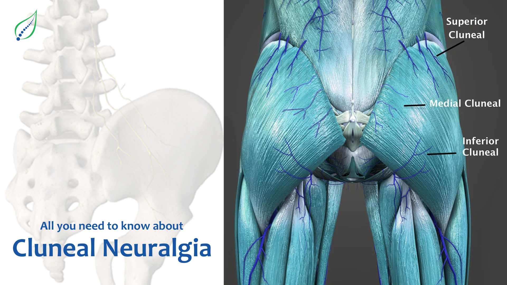 All you need to know about Cluneal Neuralgia  Best Back Pain, Slip Disc,  Knee Arthritis, Sciatica Treatment in Aundh Pune