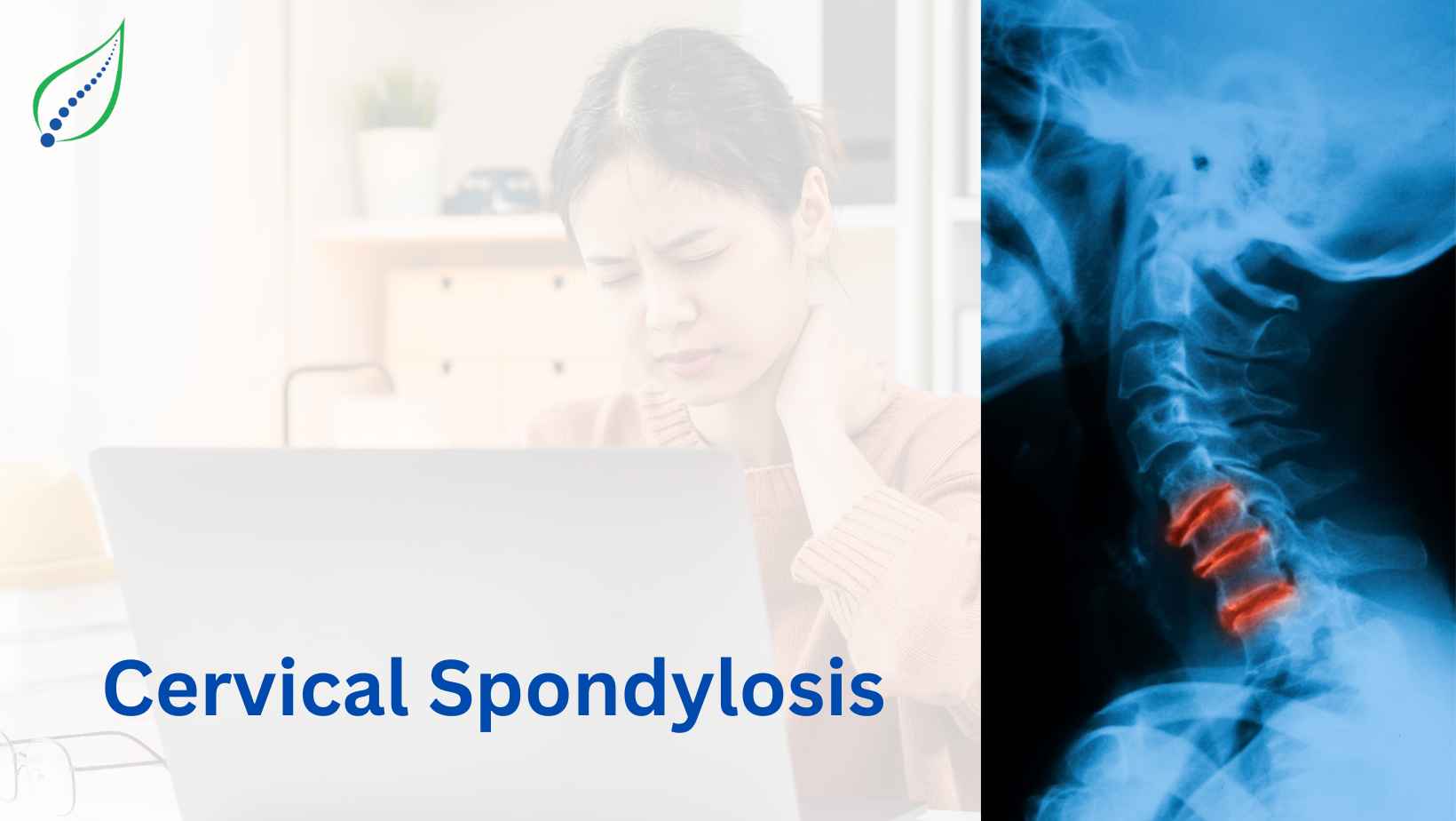 Cervical Spondylosis Care | Best Doctor in Pune | Spinalogy | Best Back ...