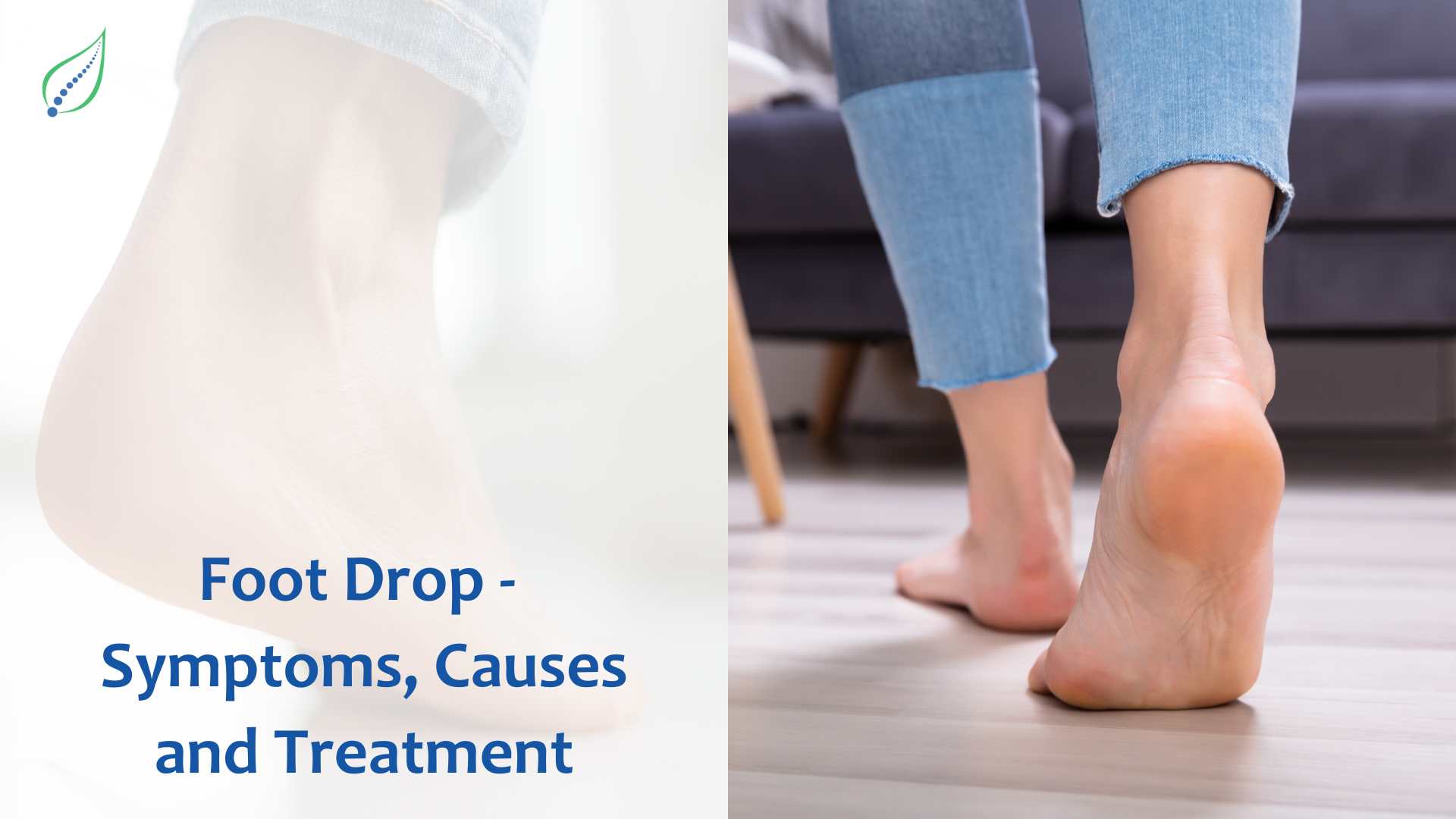 UNDERSTANDING WHAT IS 'FOOT DROP” AND ITS SYMPTOMS, CAUSES AND TREATMENT