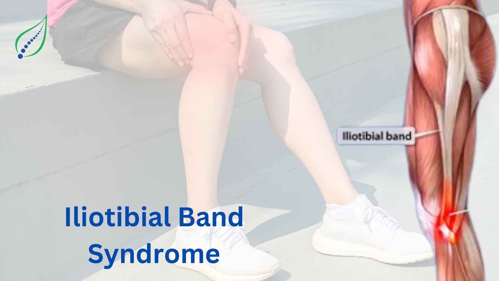 Expert Iliotibial Band Syndrome Treatment - Spinalogy Clinic, Pune ...