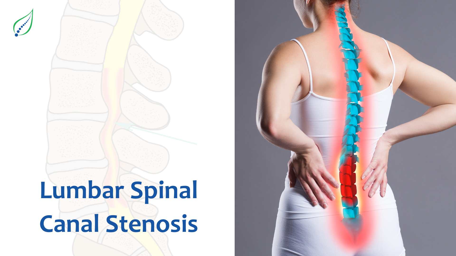 Lumbar Spinal Canal Stenosis: Causes, Symptoms, and Treatments | Blog ...