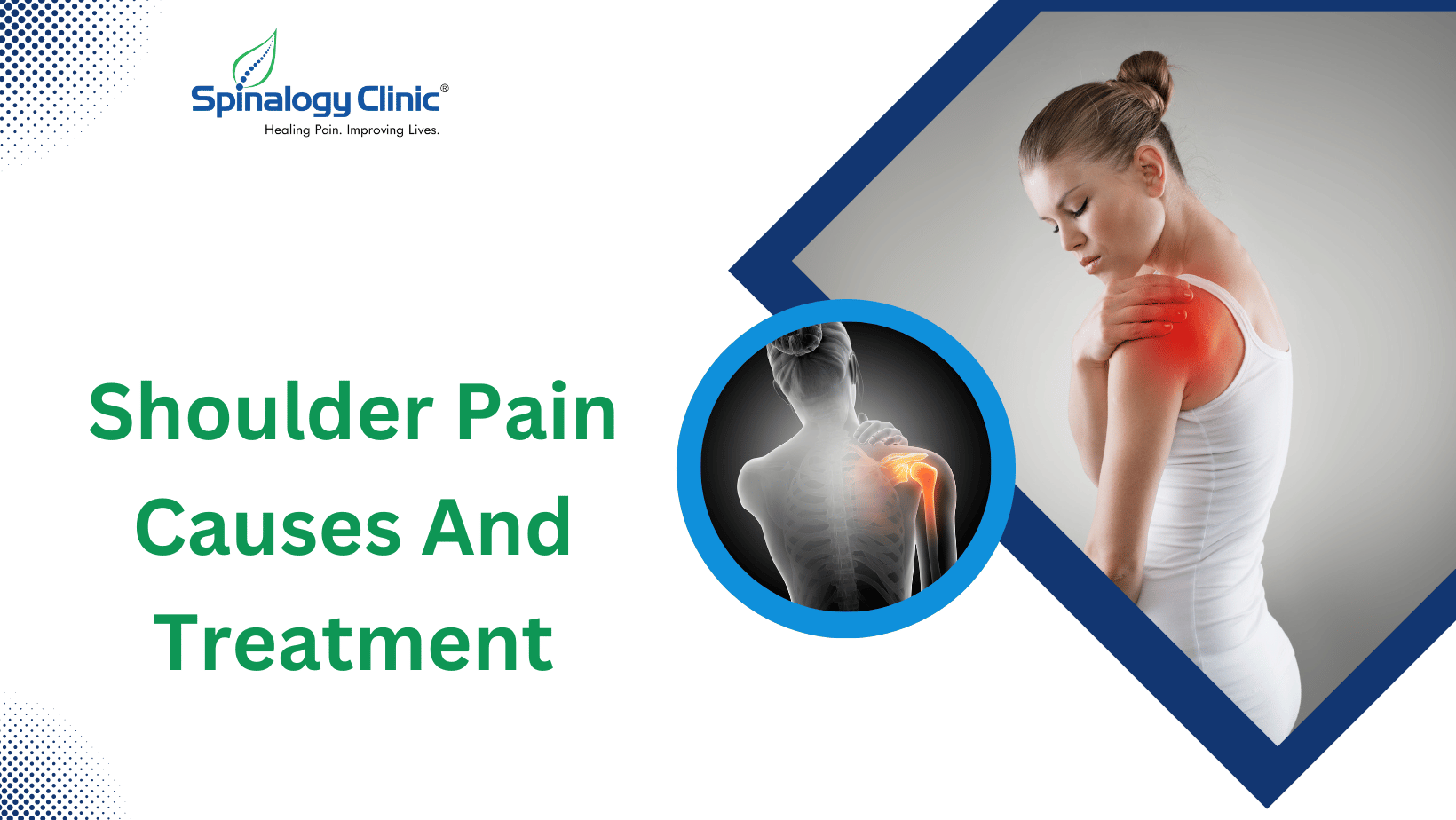 Understanding Shoulder Pain: Causes & Effective Treatment Options ...