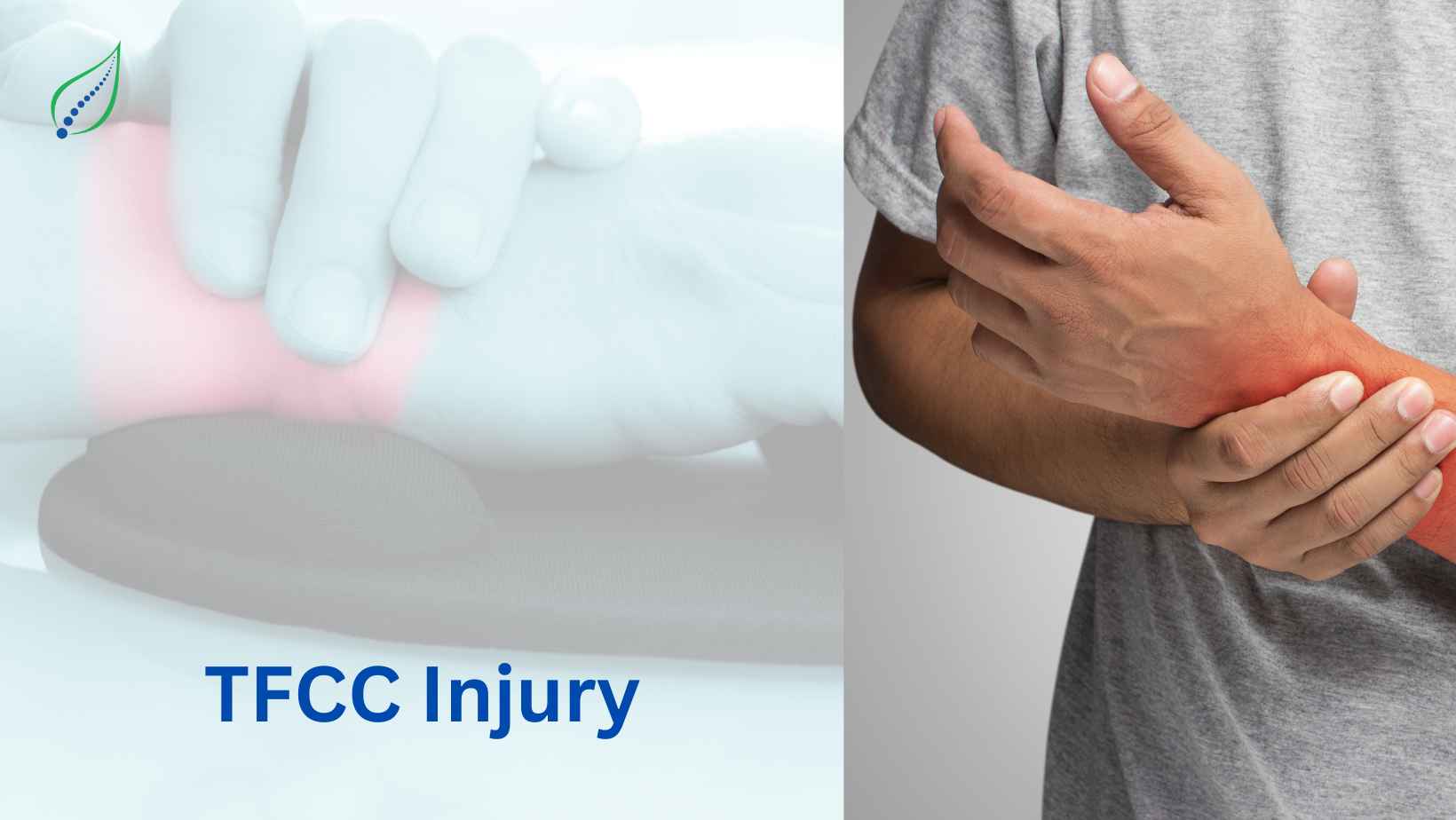 Top TFCC Treatment in Pune | Expert Care for TFCC Injury - Spinalogy ...