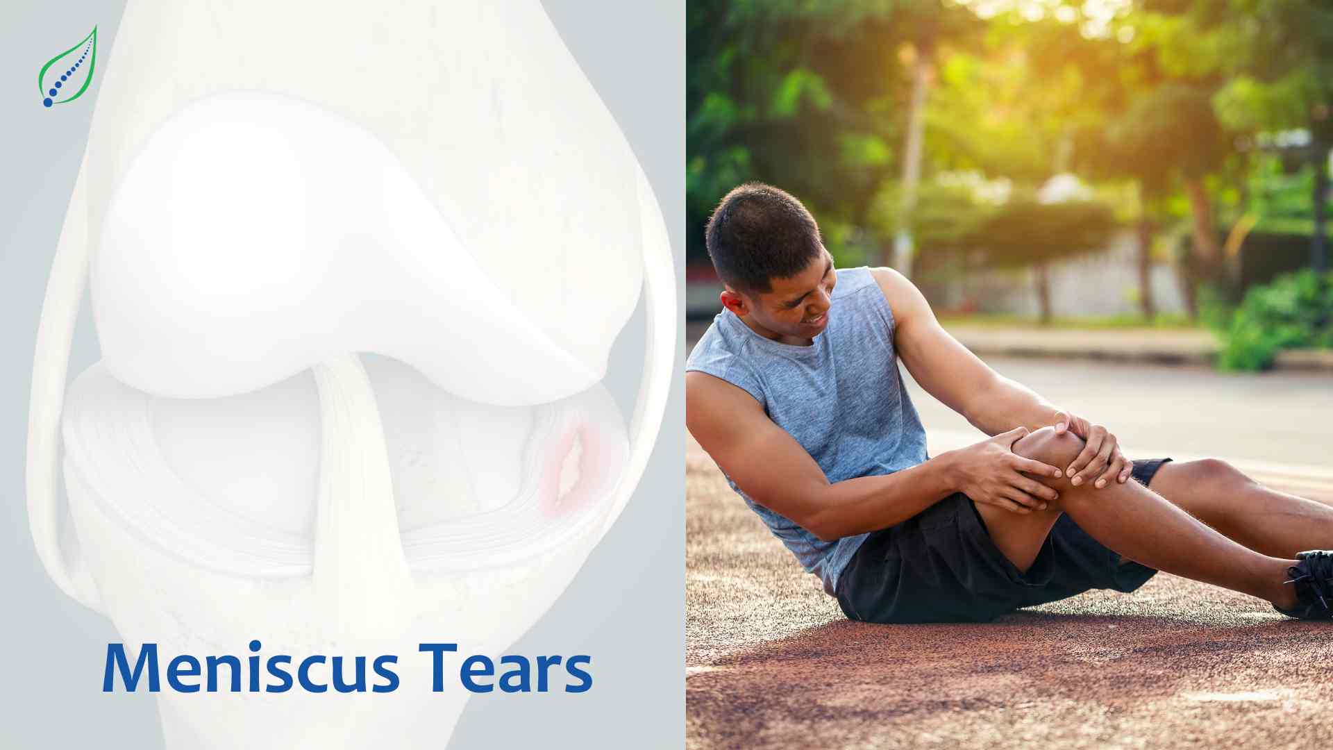 Understanding Meniscus Tears: Causes, Symptoms, and Treatment Options ...