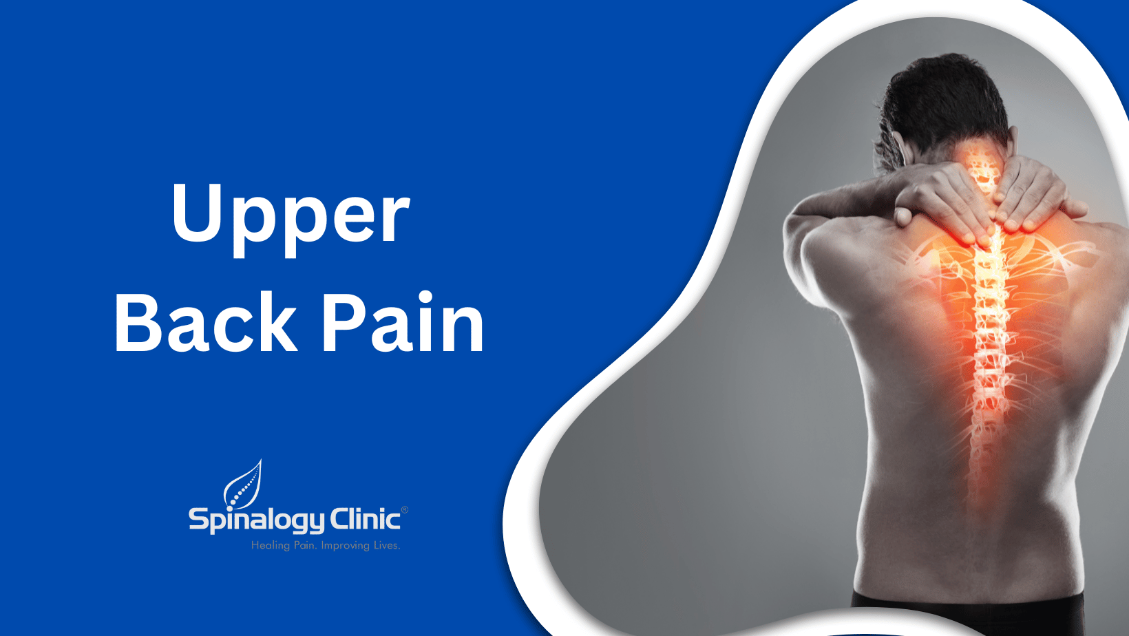 Upper Back Pain: Causes, Symptoms, and Relief Strategies | Best Back ...